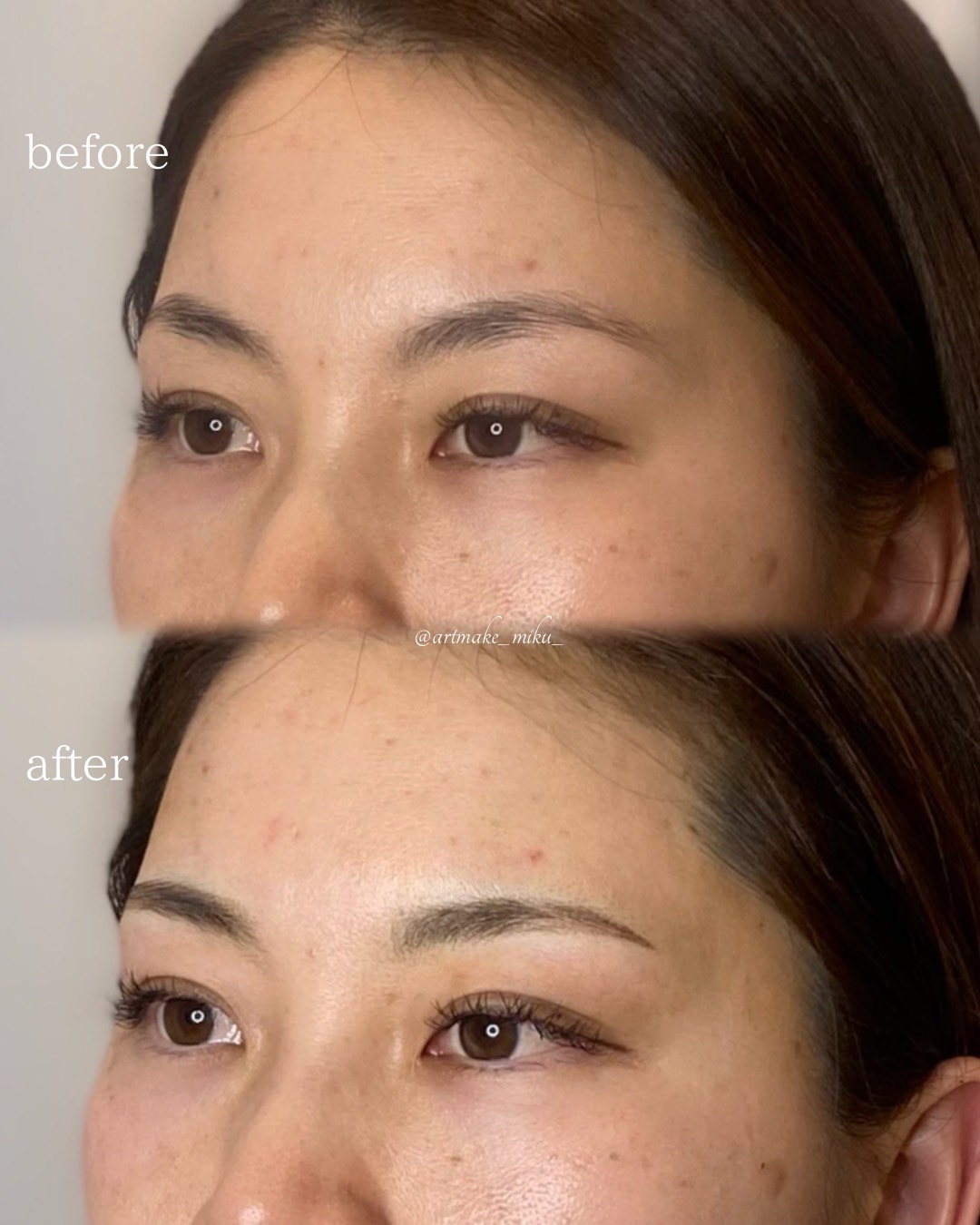 アートメイク1回目直後 before after