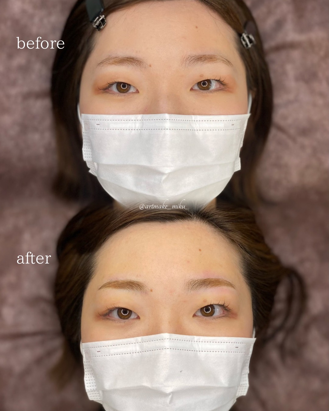 アートメイク1回目直後 before after