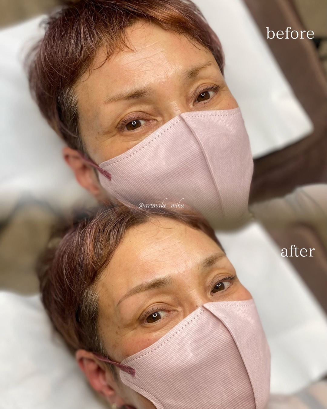 アートメイク1回目直後 before after