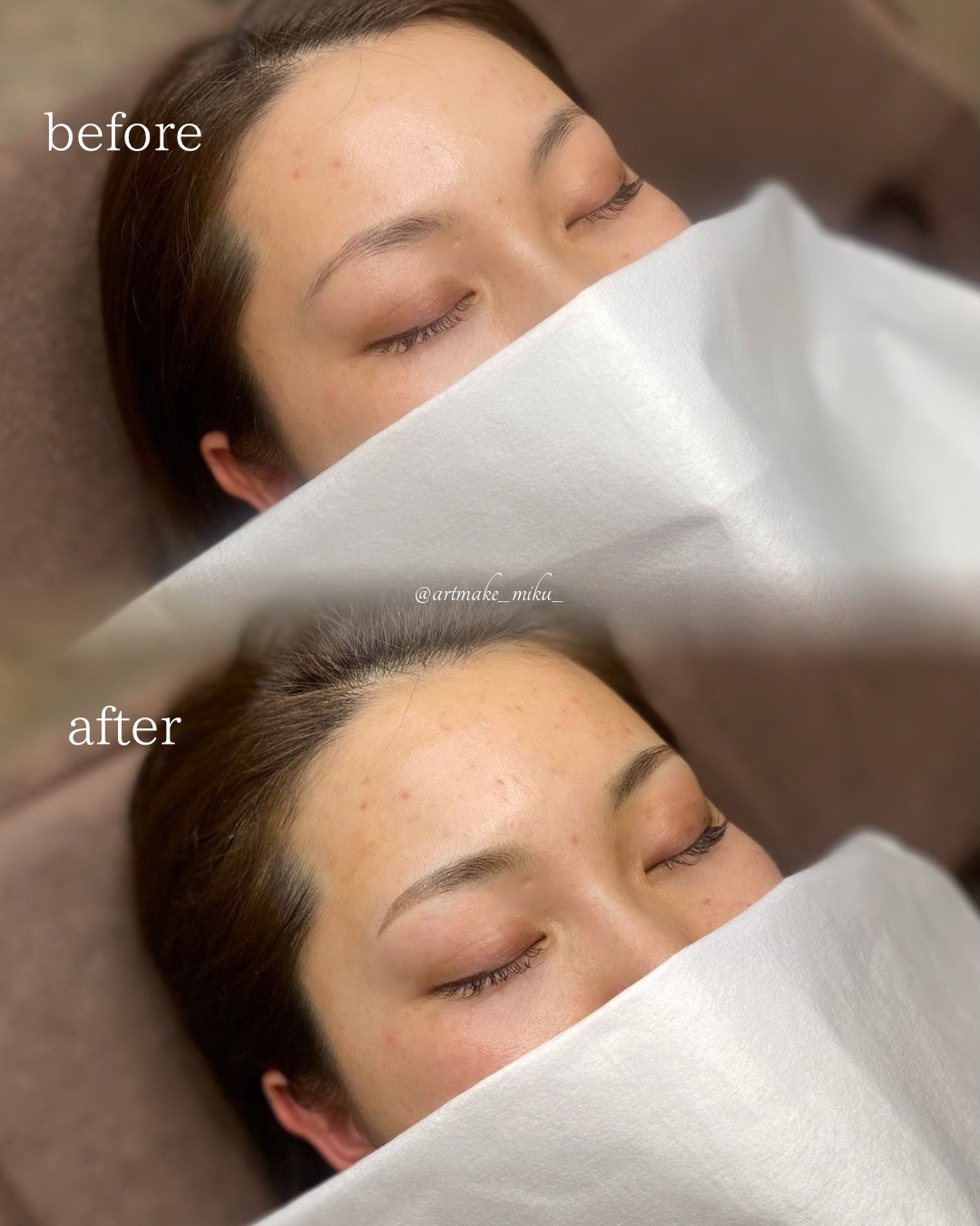 アートメイク1回目直後 before after