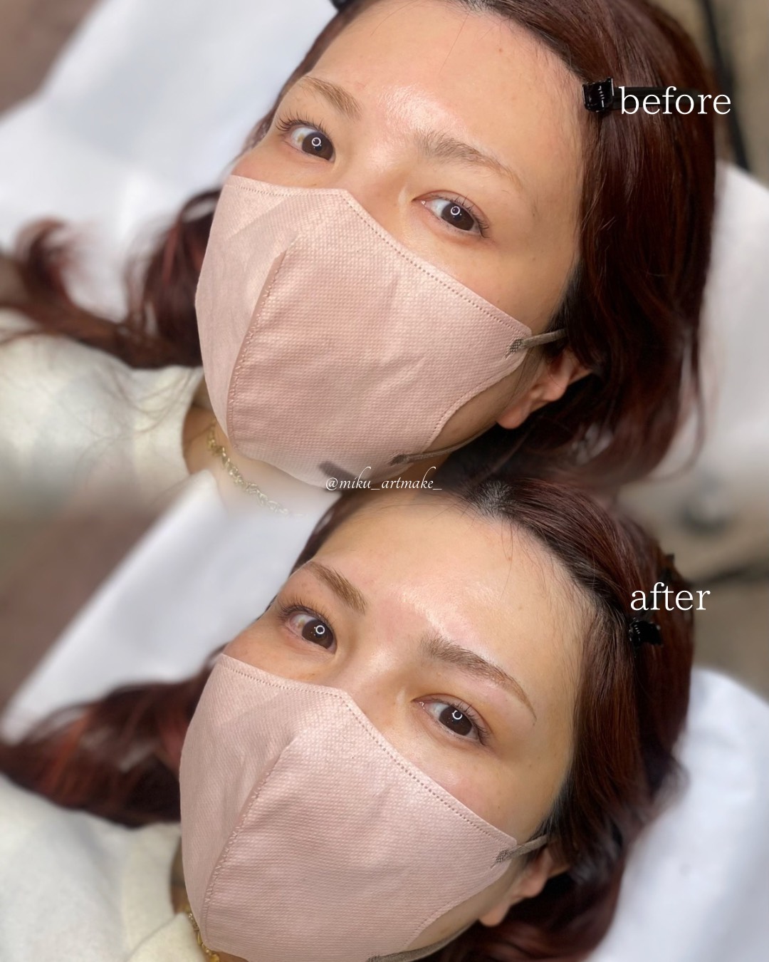 アートメイク1回目直後 before after