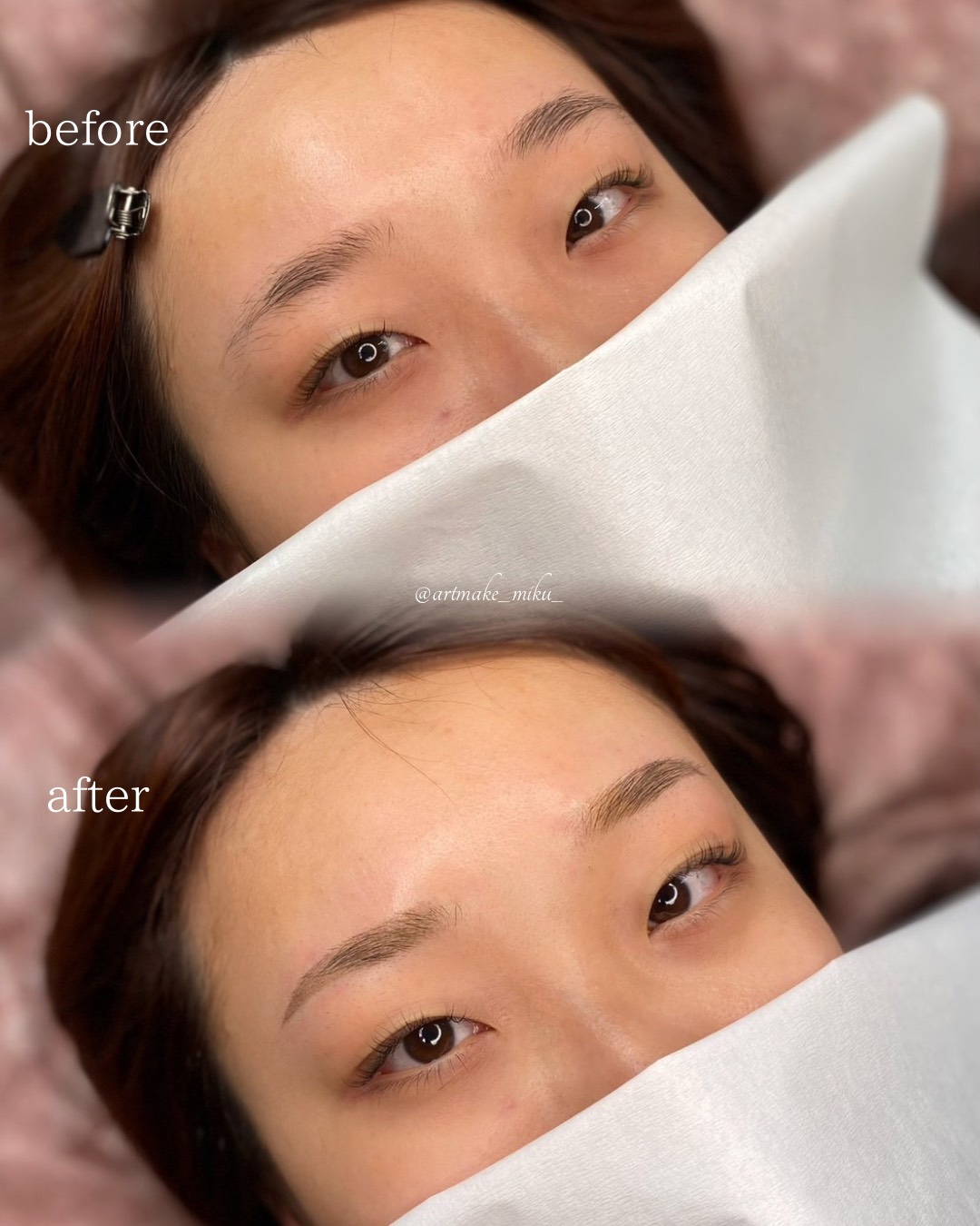 アートメイク1回目直後 before after