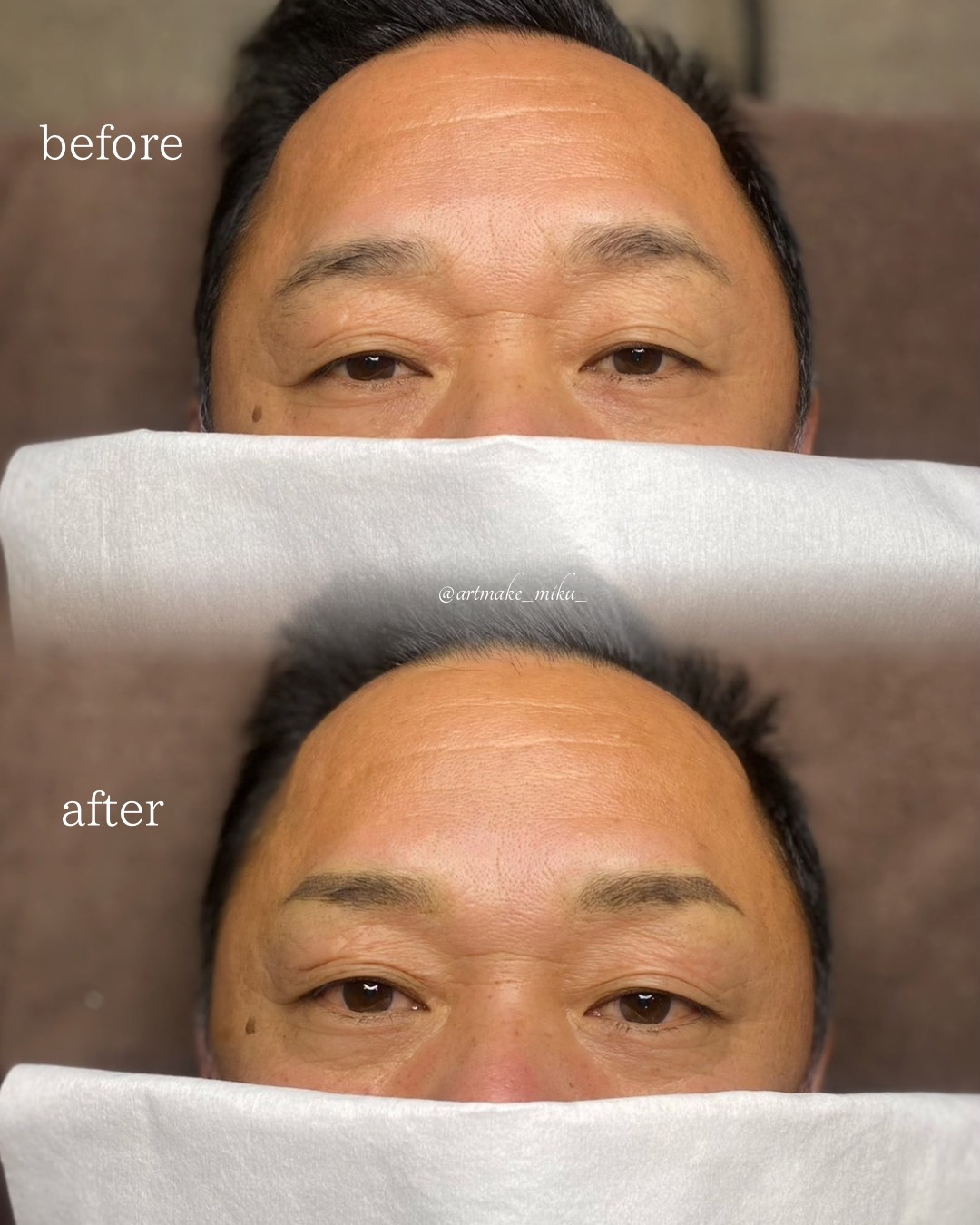 アートメイク1回目直後 before after