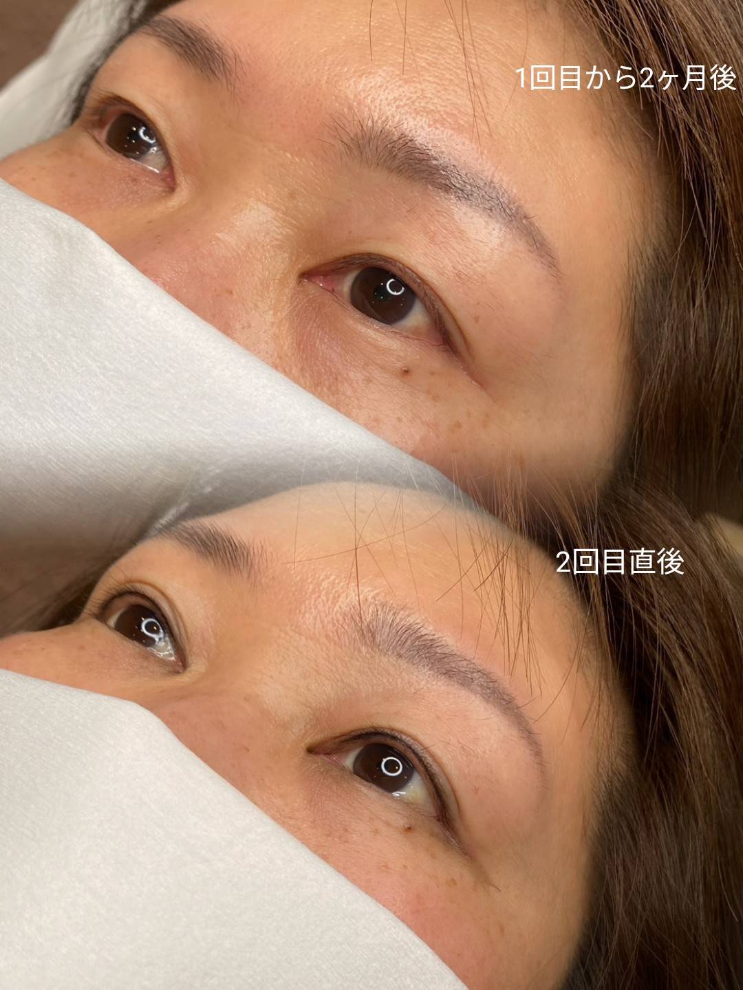 アートメイク2回目直後 before after