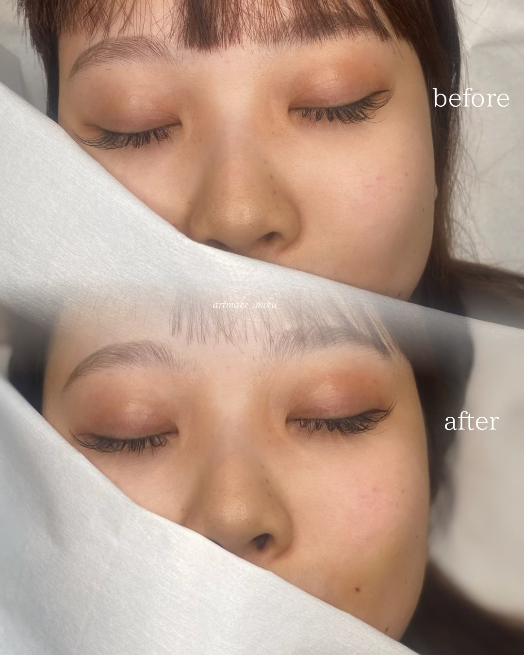 アートメイク1回目直後 before after
