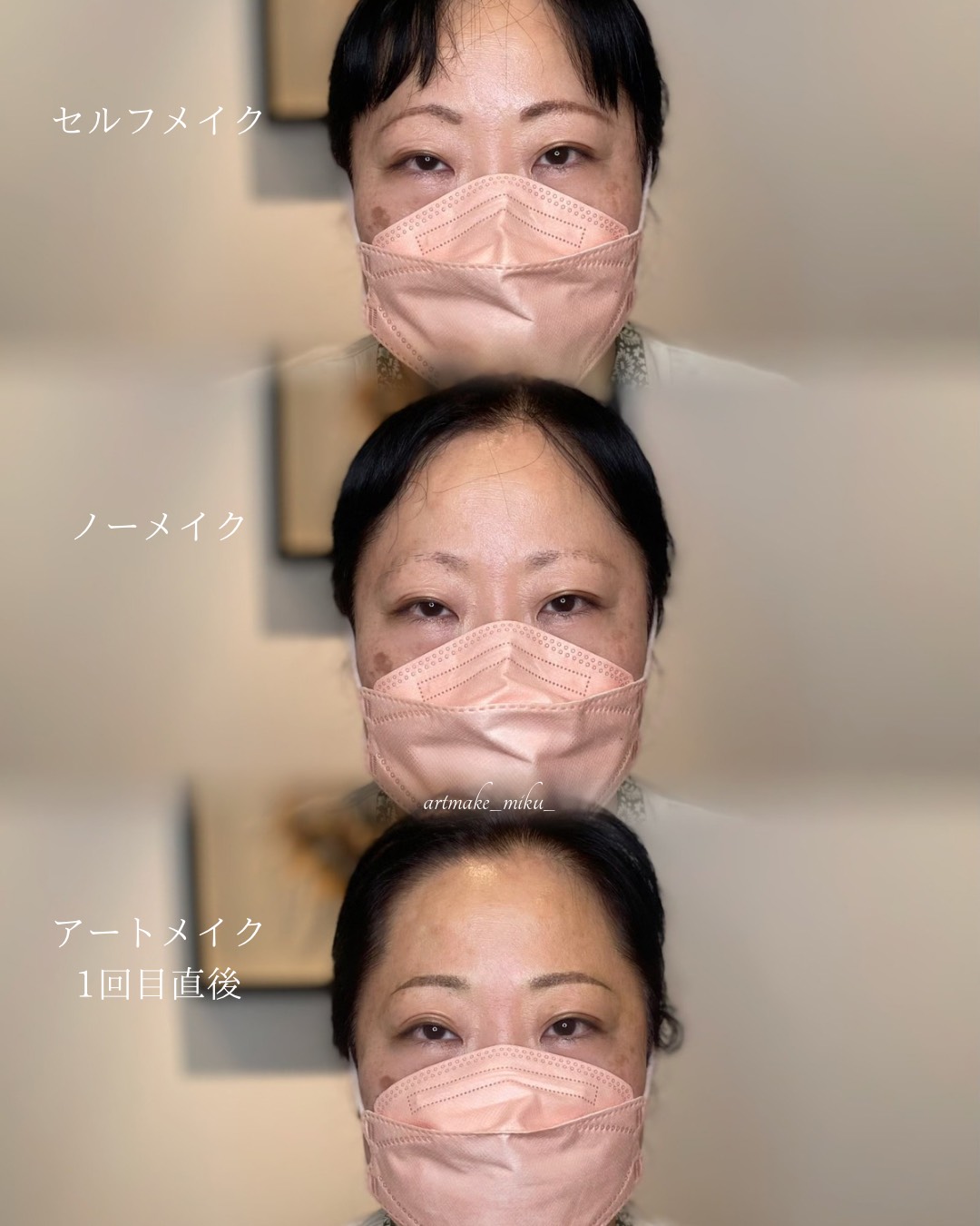 アートメイク1回目直後 before after