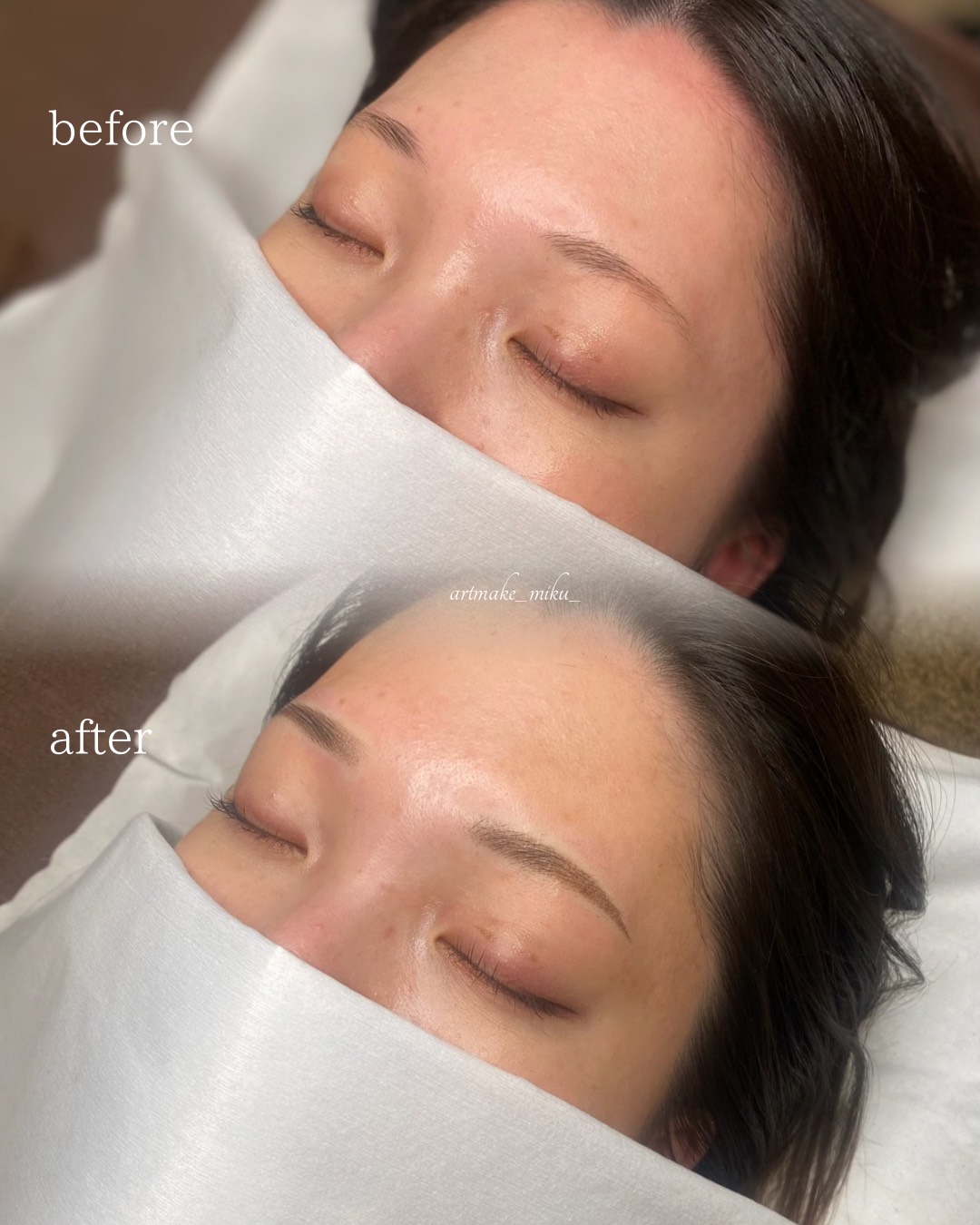 アートメイク1回目直後 before after
