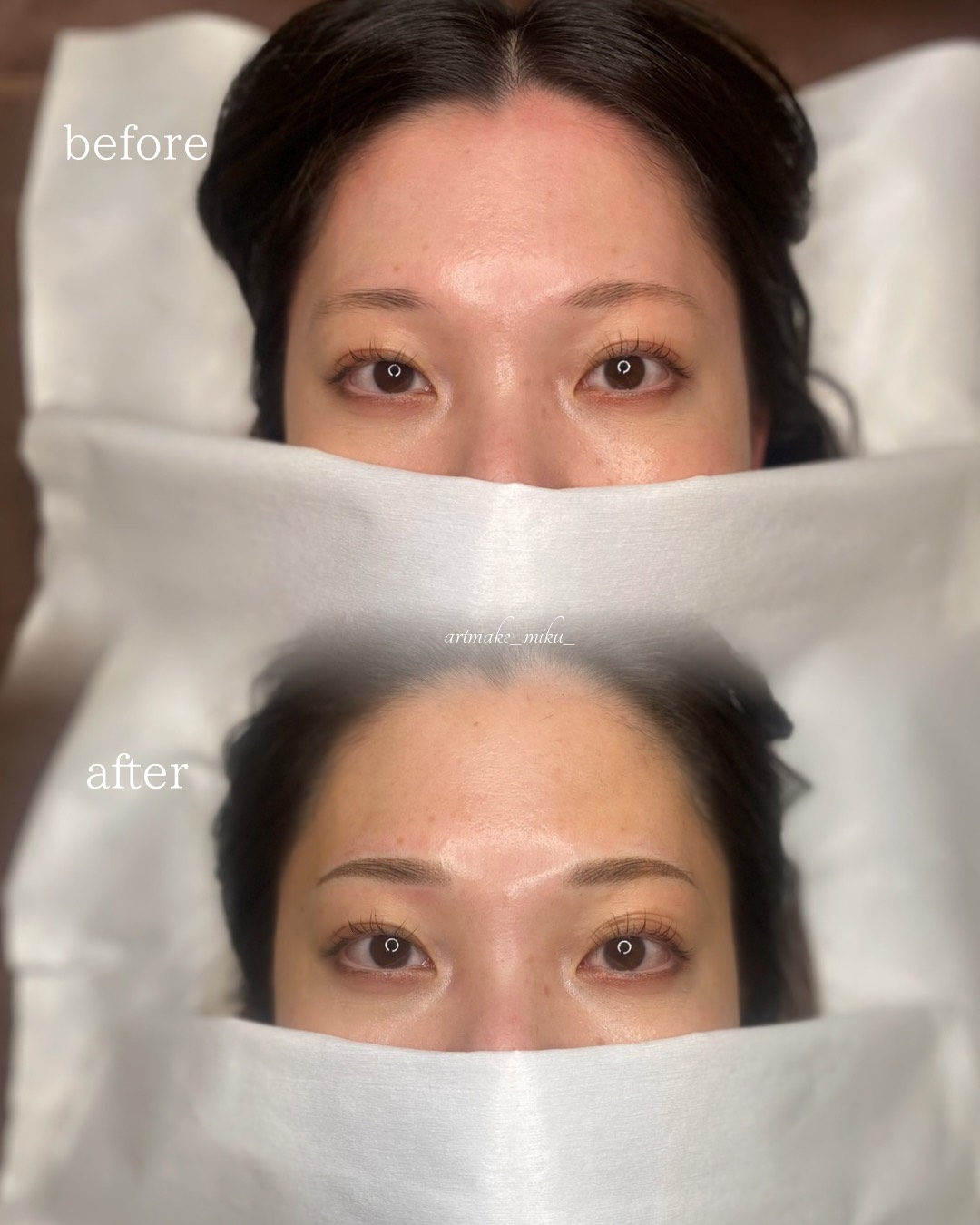 アートメイク1回目直後 before after