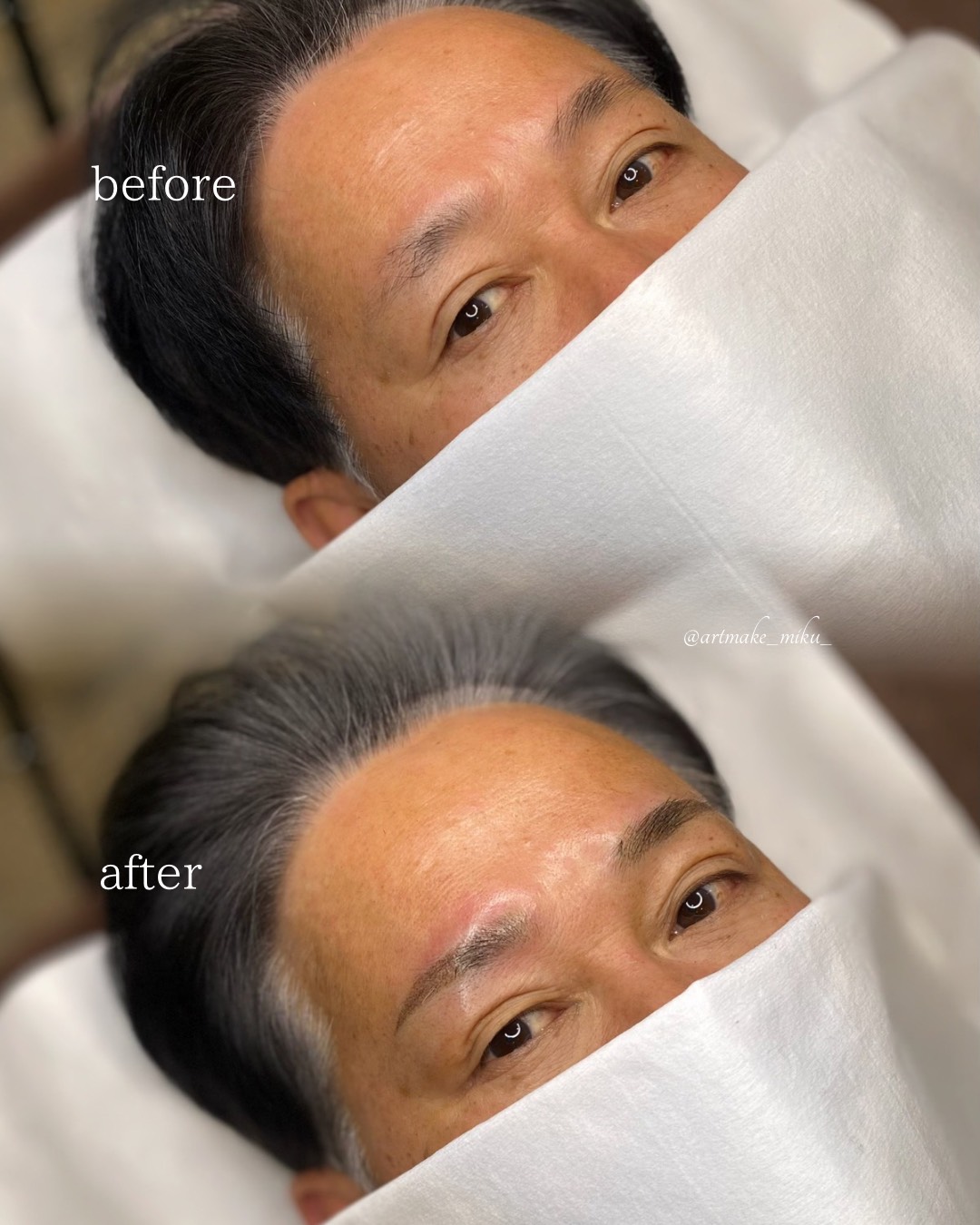 アートメイク1回目直後 before after