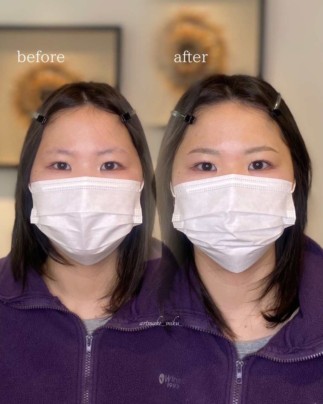アートメイク1回目直後 before after